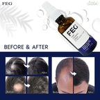 FEG Organic Hair Growth Treatment Oil ahmedmart