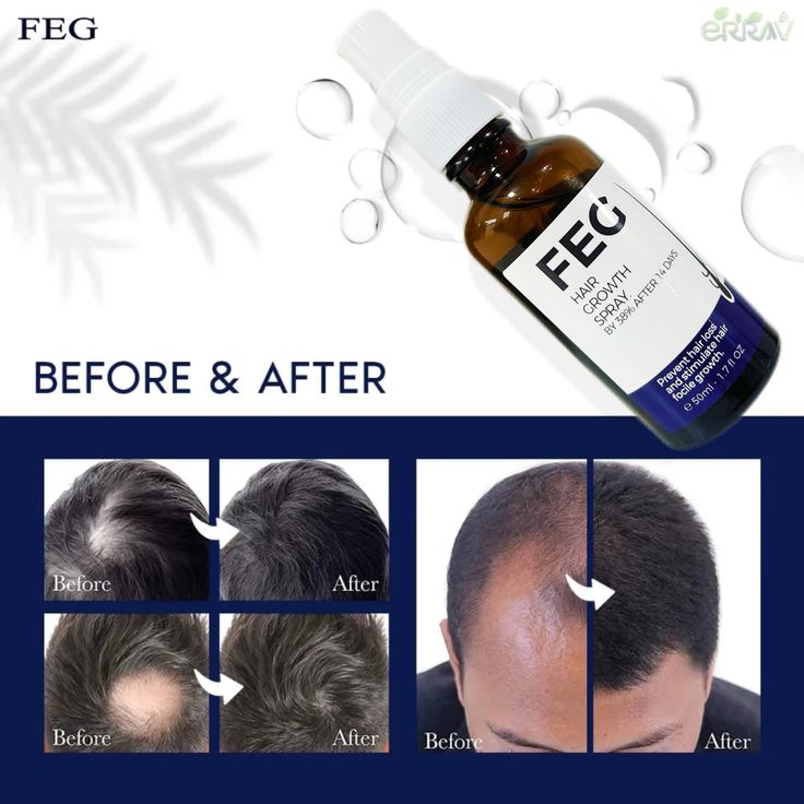 FEG Organic Hair Growth Treatment Oil ahmedmart