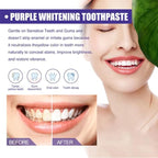 Purple Whitening Toothpaste | معجون الأسنان الأرجواني لتبييض الأسنان Zerista
