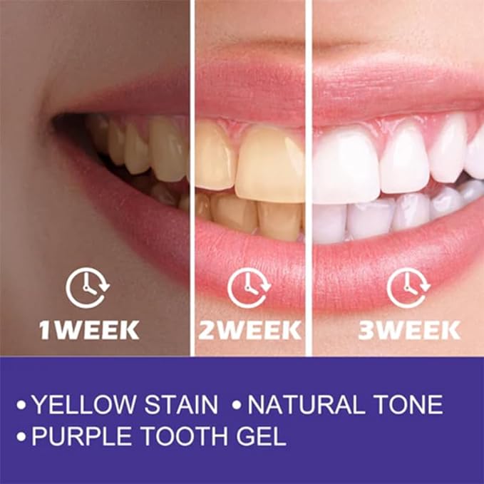 Purple Whitening Toothpaste | معجون الأسنان الأرجواني لتبييض الأسنان Zerista