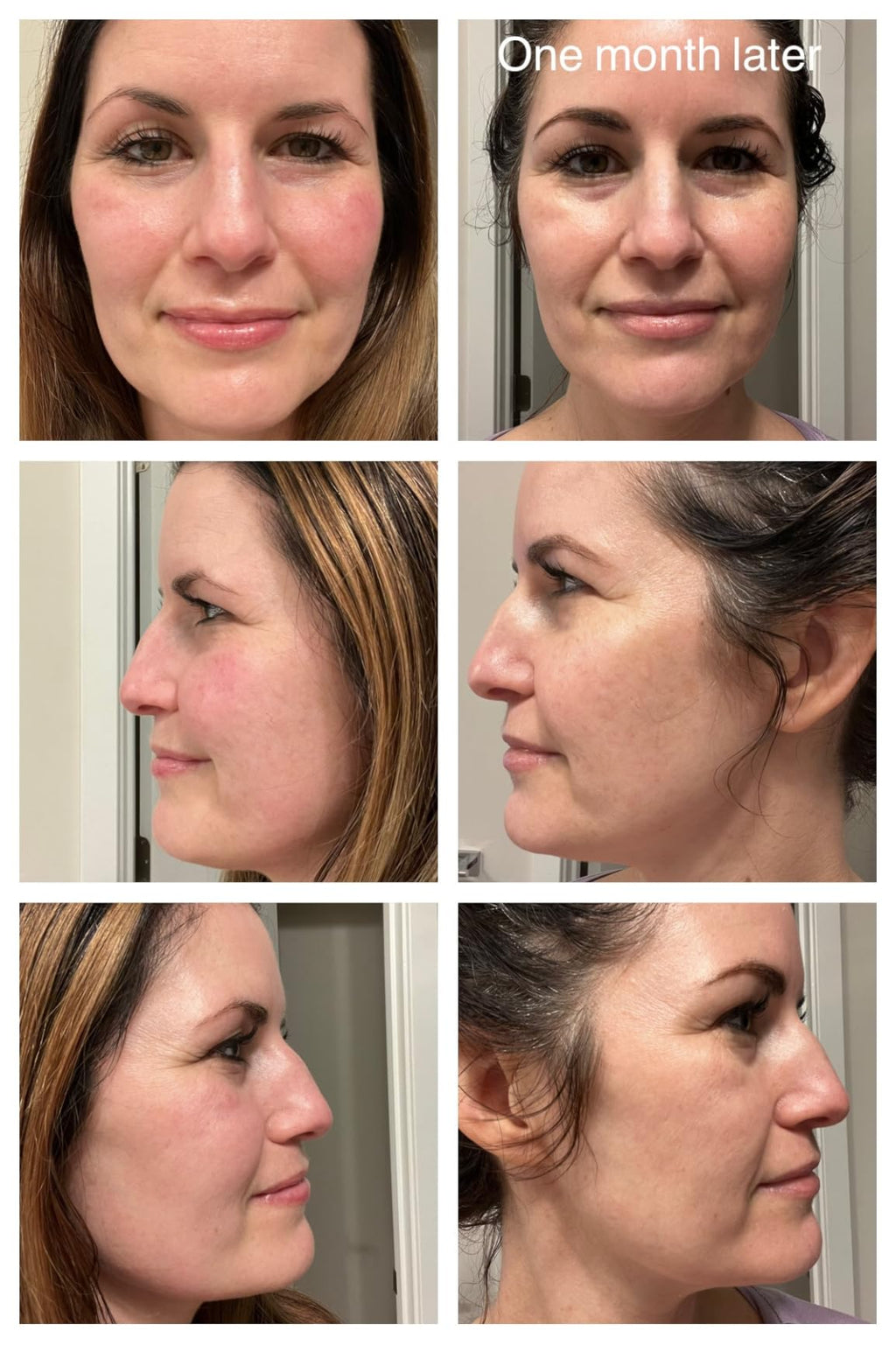 CeraVe Vitamin C Serum Zerista