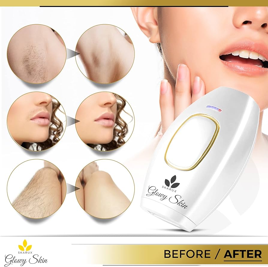 Mini Laser Hair Removal Zerista