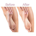 Electric Pedicure Foot File Callus Remover Zerista