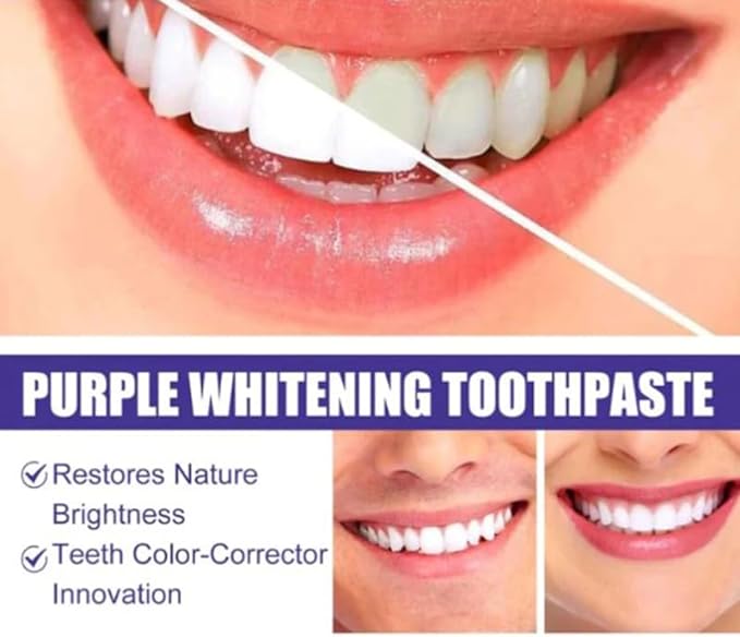 Purple Whitening Toothpaste | معجون الأسنان الأرجواني لتبييض الأسنان Tradesouqe