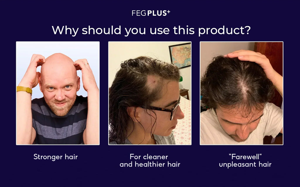FEG Organic Hair Growth Treatment Oil ahmedmart